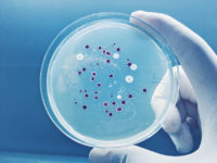 Acrovyn Resistan terhadap Bakteri dan Jamur